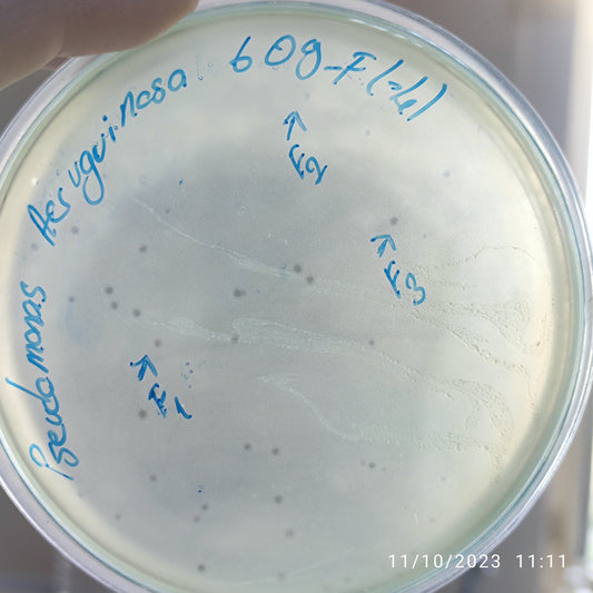 Pseudomonas aeruginosa bacteriophage 130609F