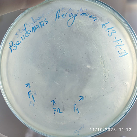 Pseudomonas aeruginosa bacteriophage 130613F