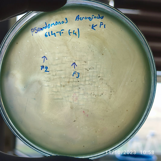 Pseudomonas aeruginosa bacteriophage 130614F