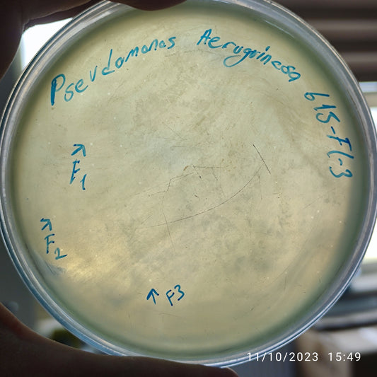 Pseudomonas aeruginosa bacteriophage 130615F