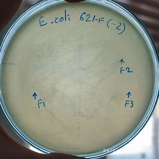 Escherichia coli bacteriophage 100621F