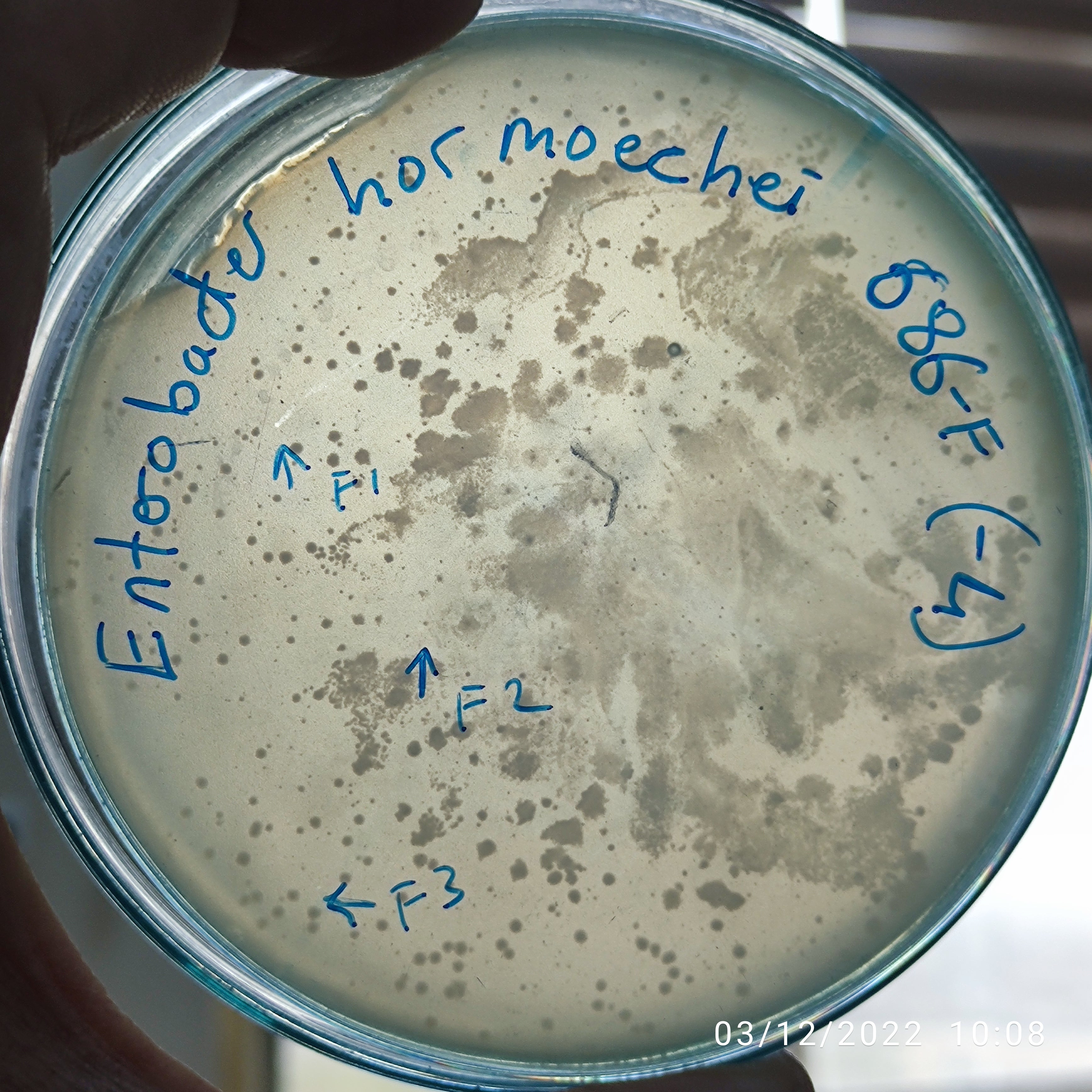 Enterobacter Hormechei Biochemical Urease Citrate Enterobacter hormaechei bacteriophage 200686F – Mikroliz