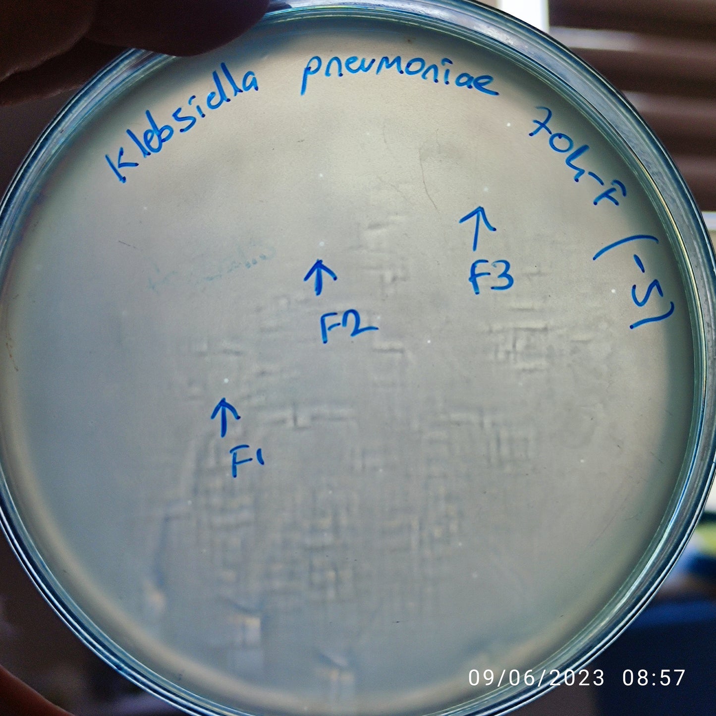 Klebsiella pneumoniae bacteriophage 180704F