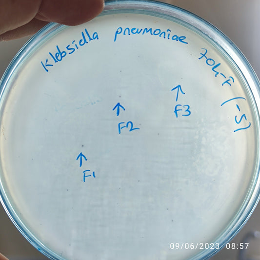 Klebsiella pneumoniae bacteriophage 180704F