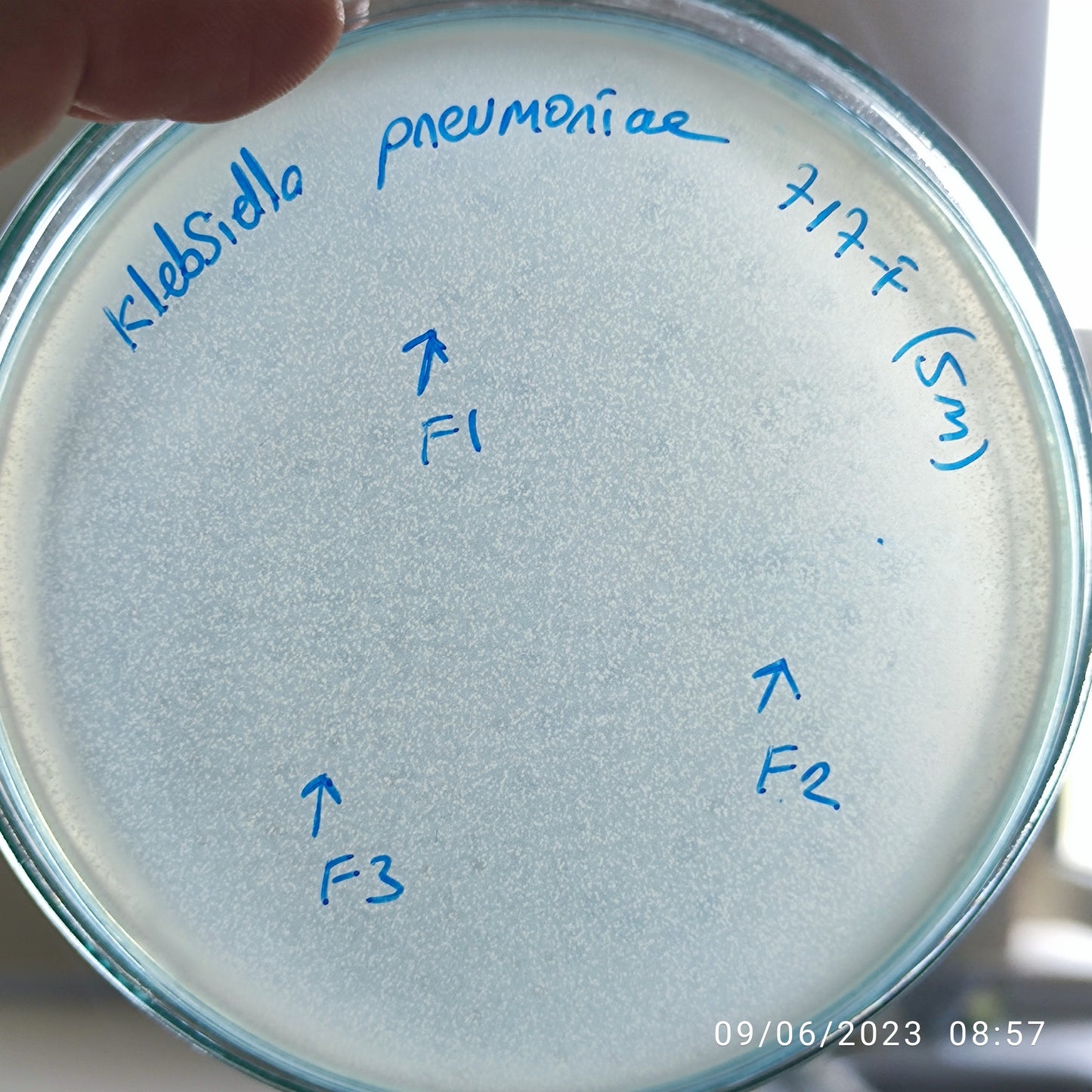 Klebsiella pneumoniae bacteriophage 180717F