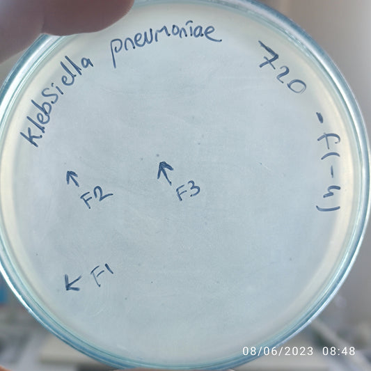 Klebsiella pneumoniae bacteriophage 180720F