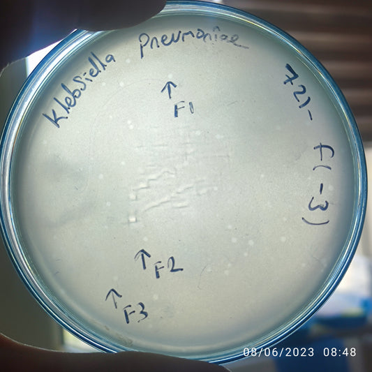 Klebsiella pneumoniae bacteriophage 180721F