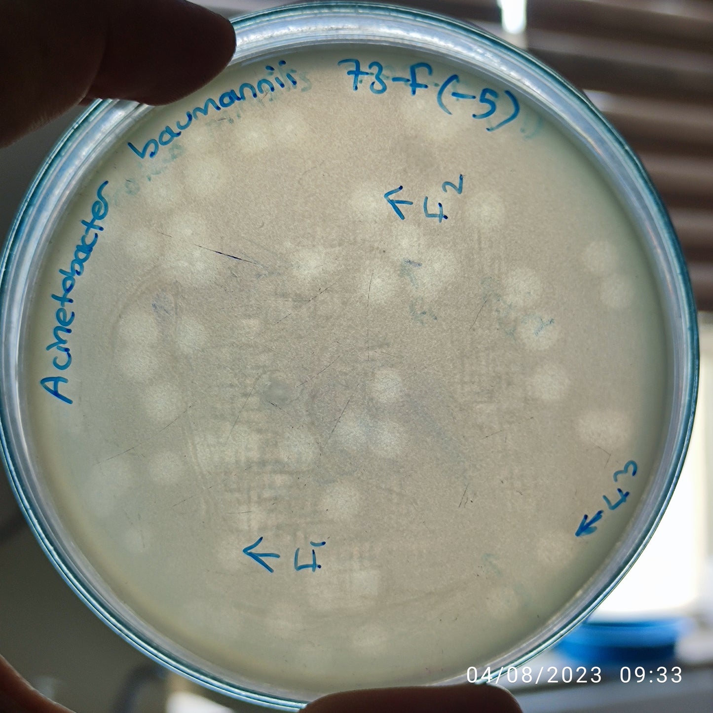 Acinetobacter baumannii bacteriophage 120073F
