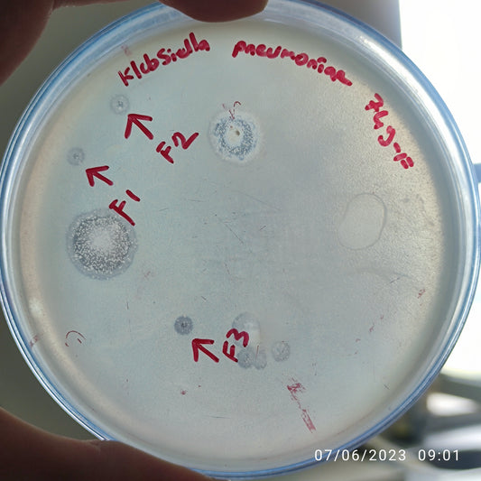 Klebsiella pneumoniae bacteriophage 180749F