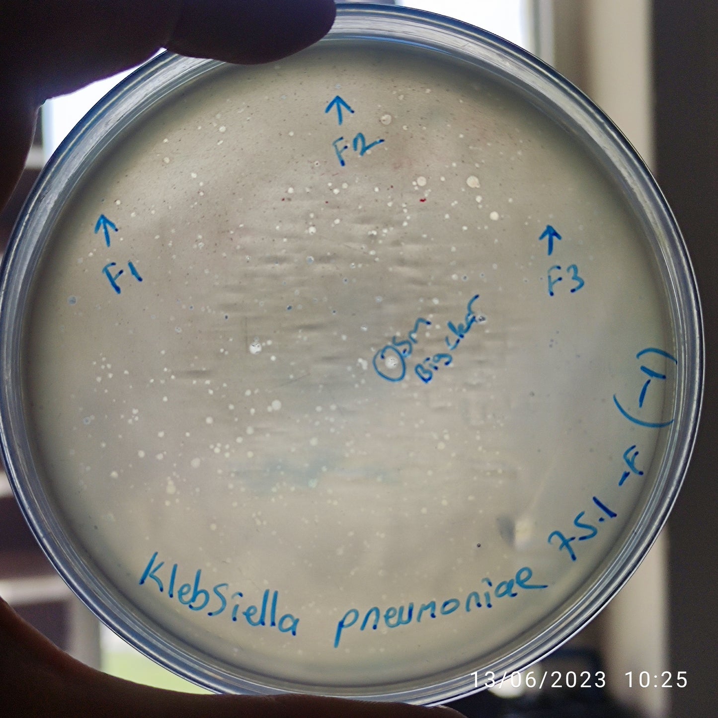 Klebsiella pneumoniae bacteriophage 180751F