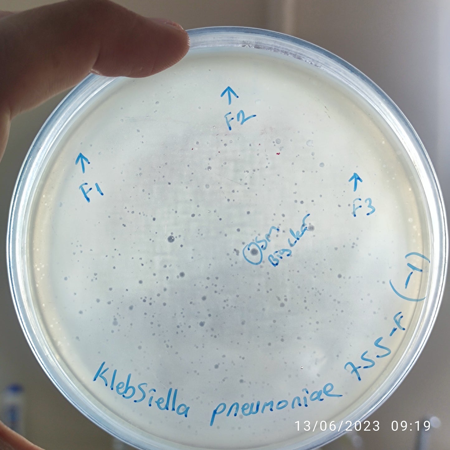 Klebsiella pneumoniae bacteriophage 180755F