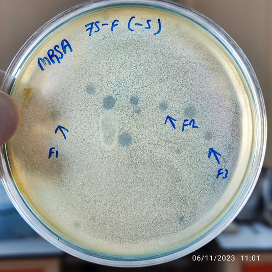 Staphylococcus aureus bacteriophage 150075F