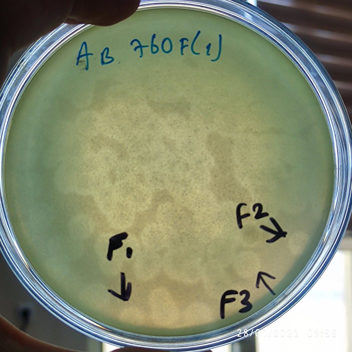 Acinetobacter baumannii bacteriophage 120760F