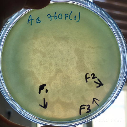 Acinetobacter baumannii bacteriophage 120760F