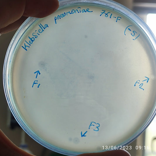 Klebsiella pneumoniae bacteriophage 180761F