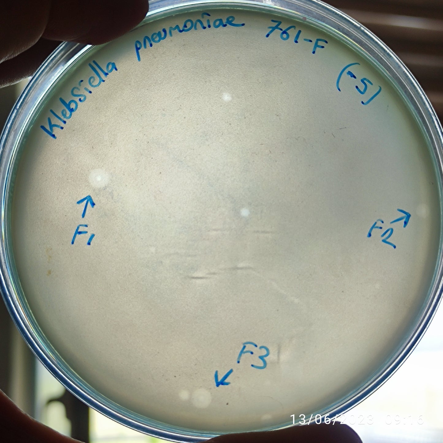 Klebsiella pneumoniae bacteriophage 180761F