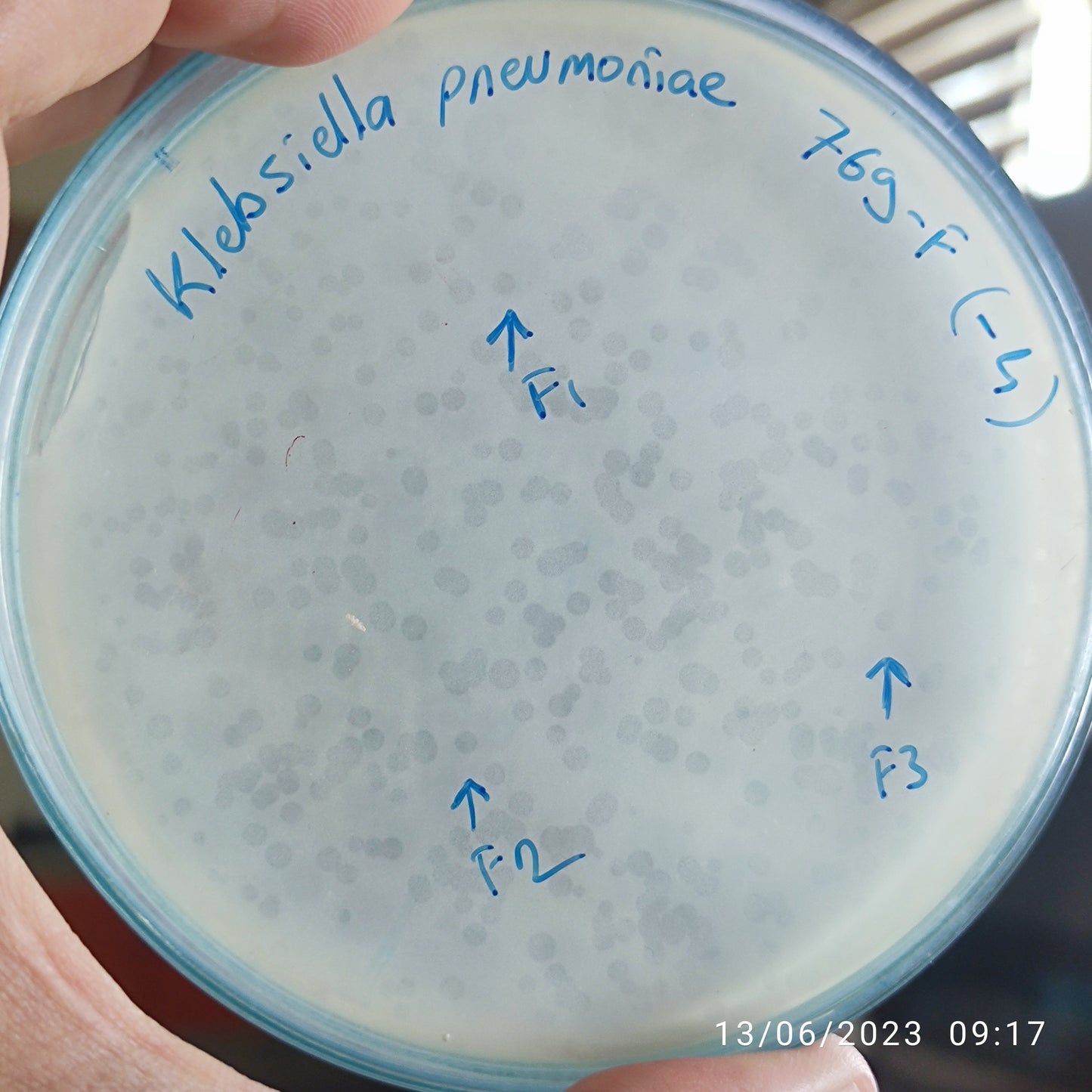 Klebsiella pneumoniae bacteriophage 180769F