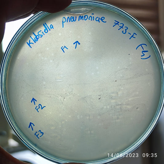 Klebsiella pneumoniae bacteriophage 180773F