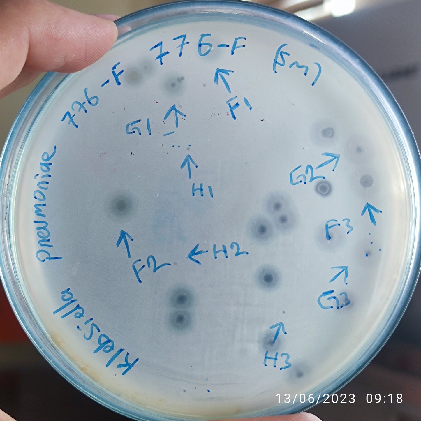 Klebsiella pneumoniae bacteriophage 180776F