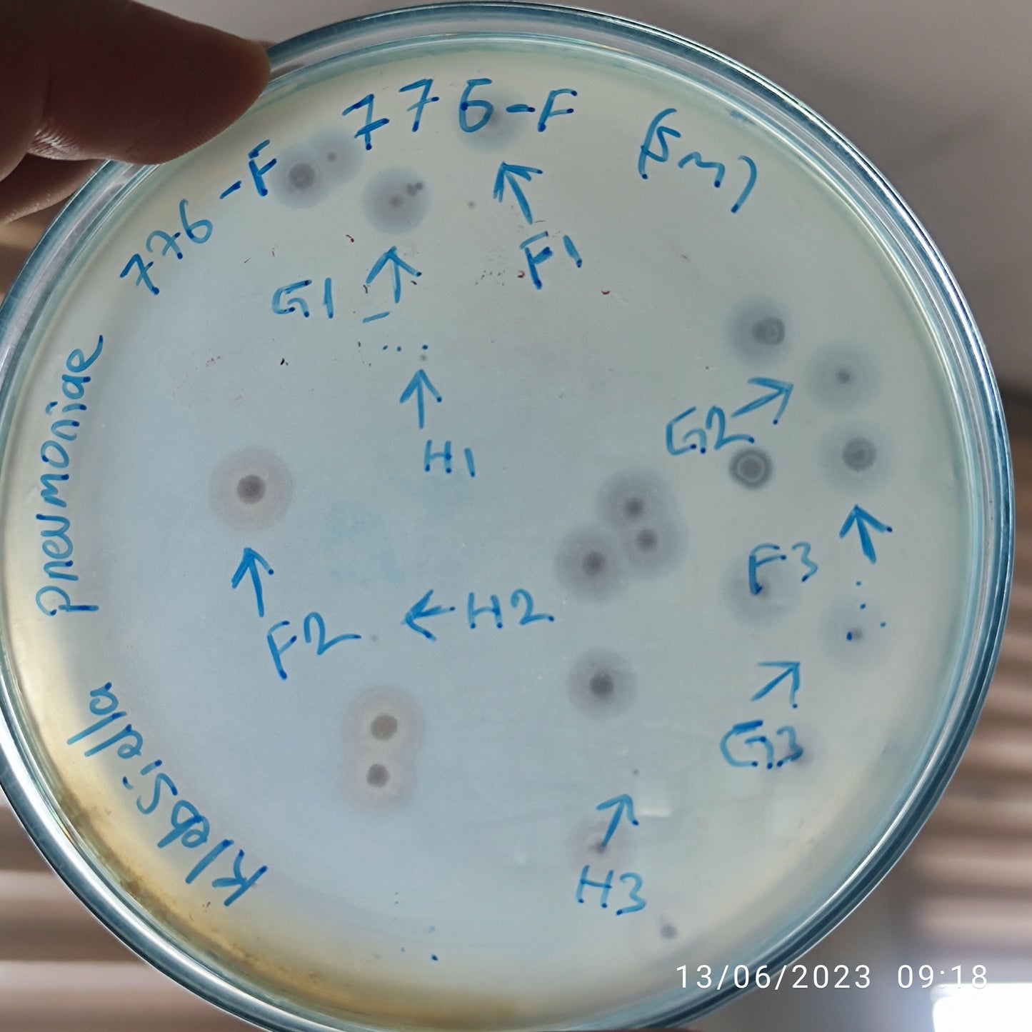 Klebsiella pneumoniae bacteriophage 180776G