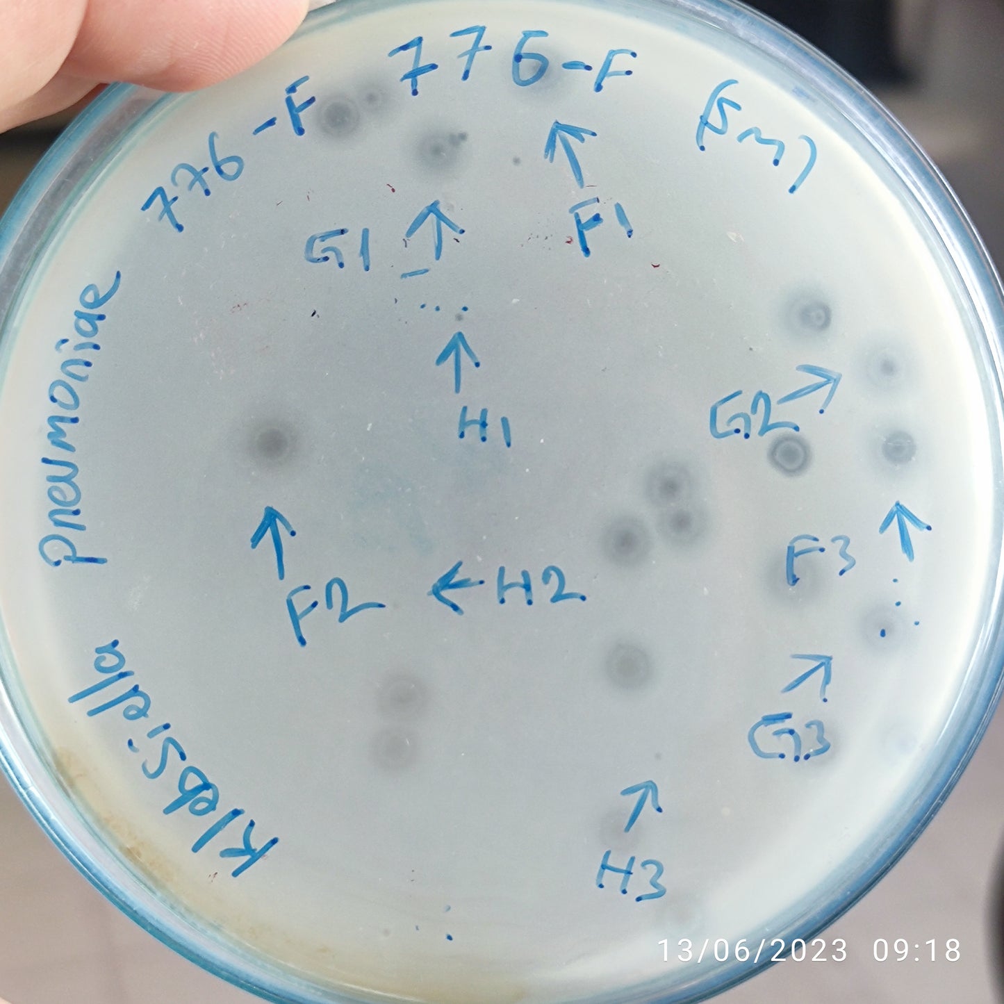 Klebsiella pneumoniae bacteriophage 180776H