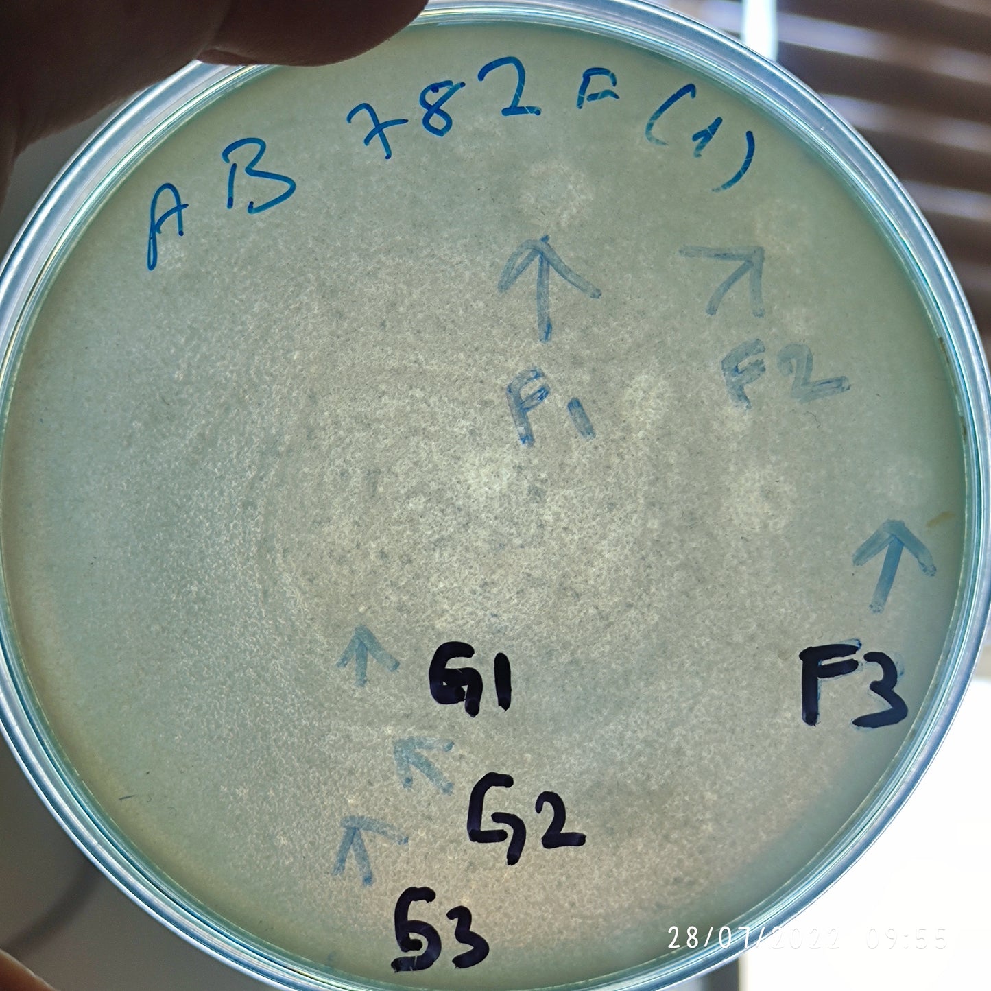 Acinetobacter baumannii bacteriophage 120782F