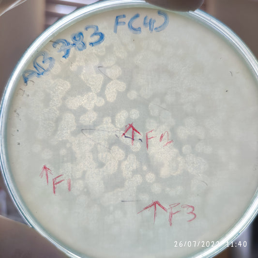 Acinetobacter baumannii bacteriophage 120783F