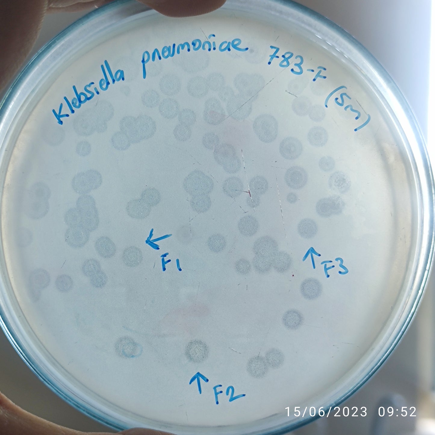 Klebsiella pneumoniae bacteriophage 180783F