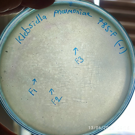 Klebsiella pneumoniae bacteriophage 180785F