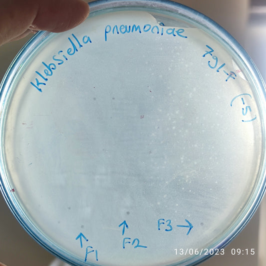 Klebsiella pneumoniae bacteriophage 180791F