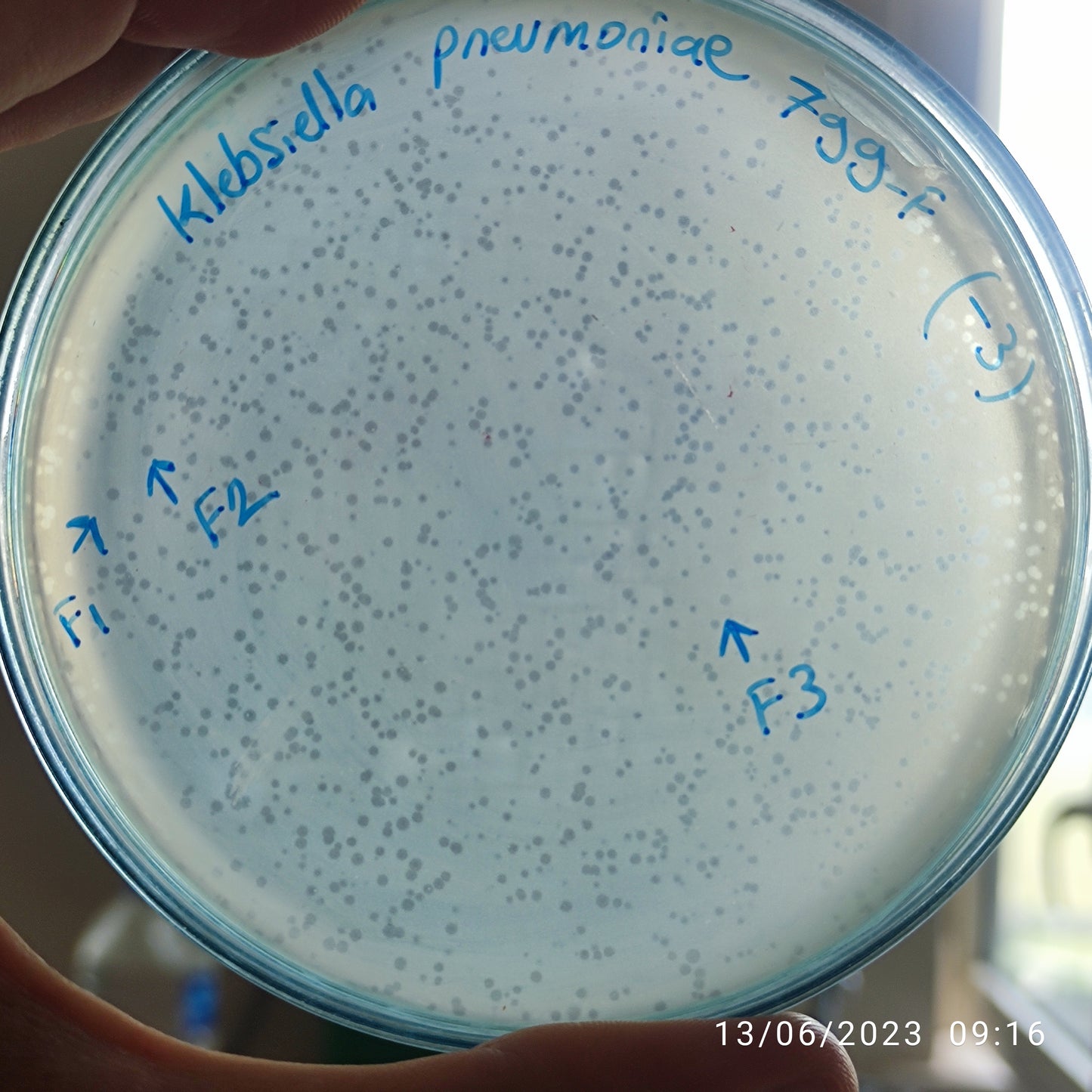 Klebsiella pneumoniae bacteriophage 180799F