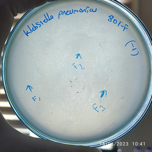 Klebsiella pneumoniae bacteriophage 180801F