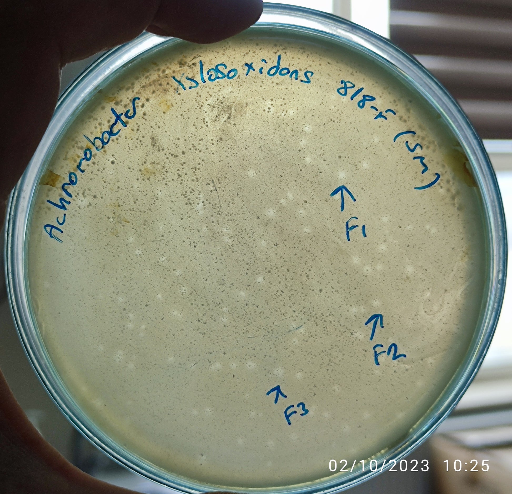 Achromobacter xylosoxidans bacteriophage 200818F Mikroliz