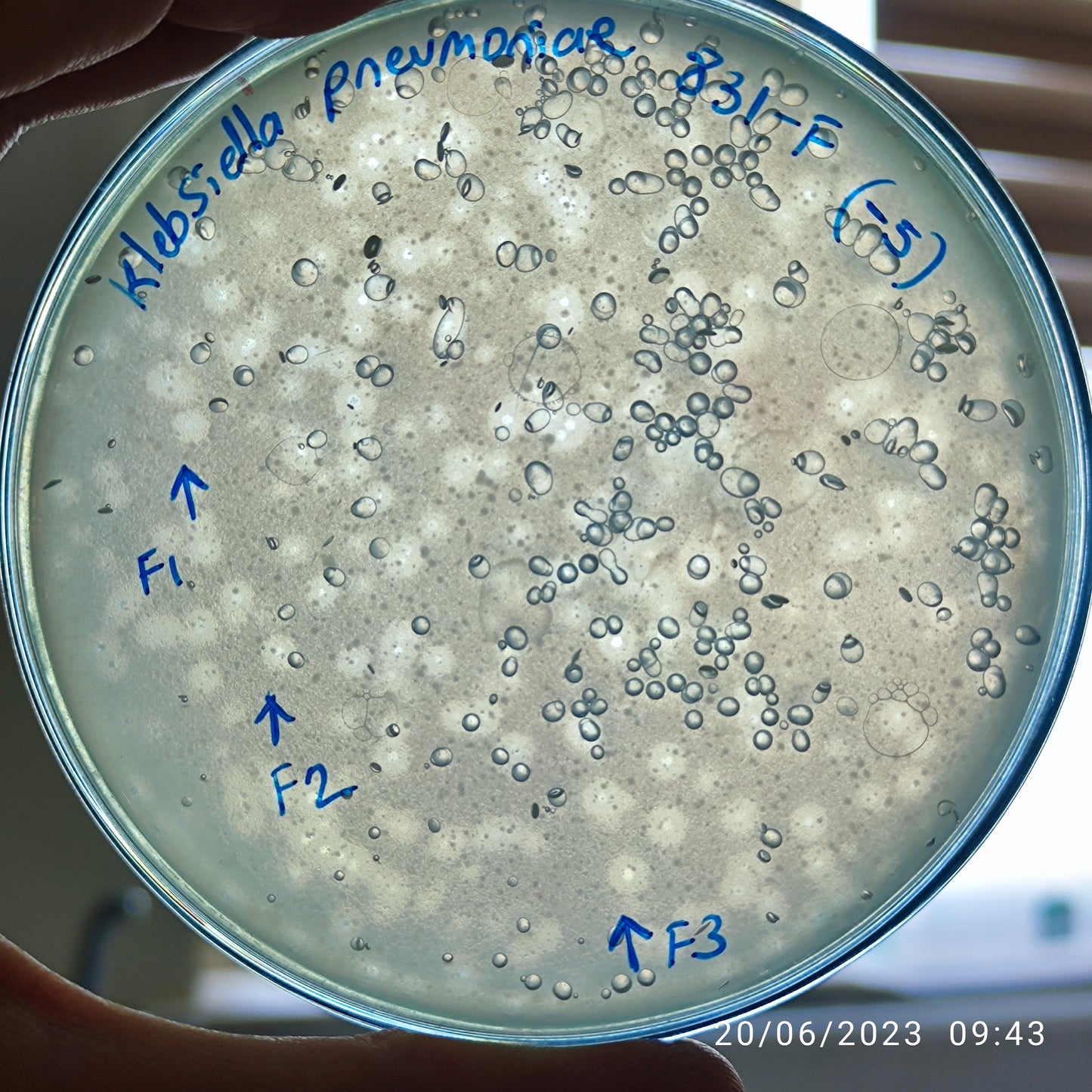 Klebsiella pneumoniae bacteriophage 180831F