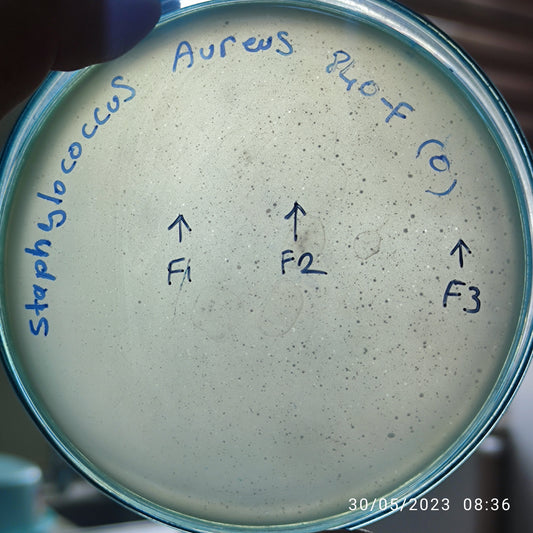 Staphylococcus aureus bacteriophage 152840F
