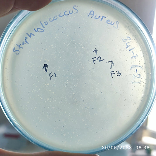 Staphylococcus aureus bacteriophage 152841F