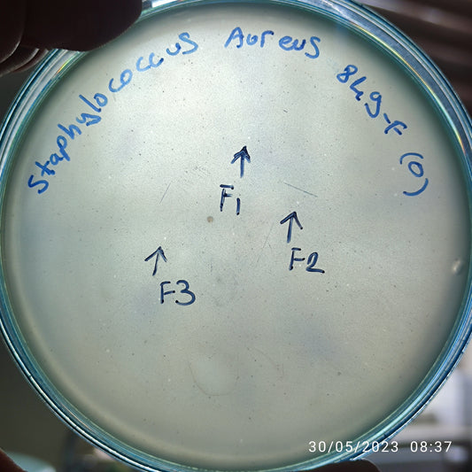 Staphylococcus aureus bacteriophage 152849F