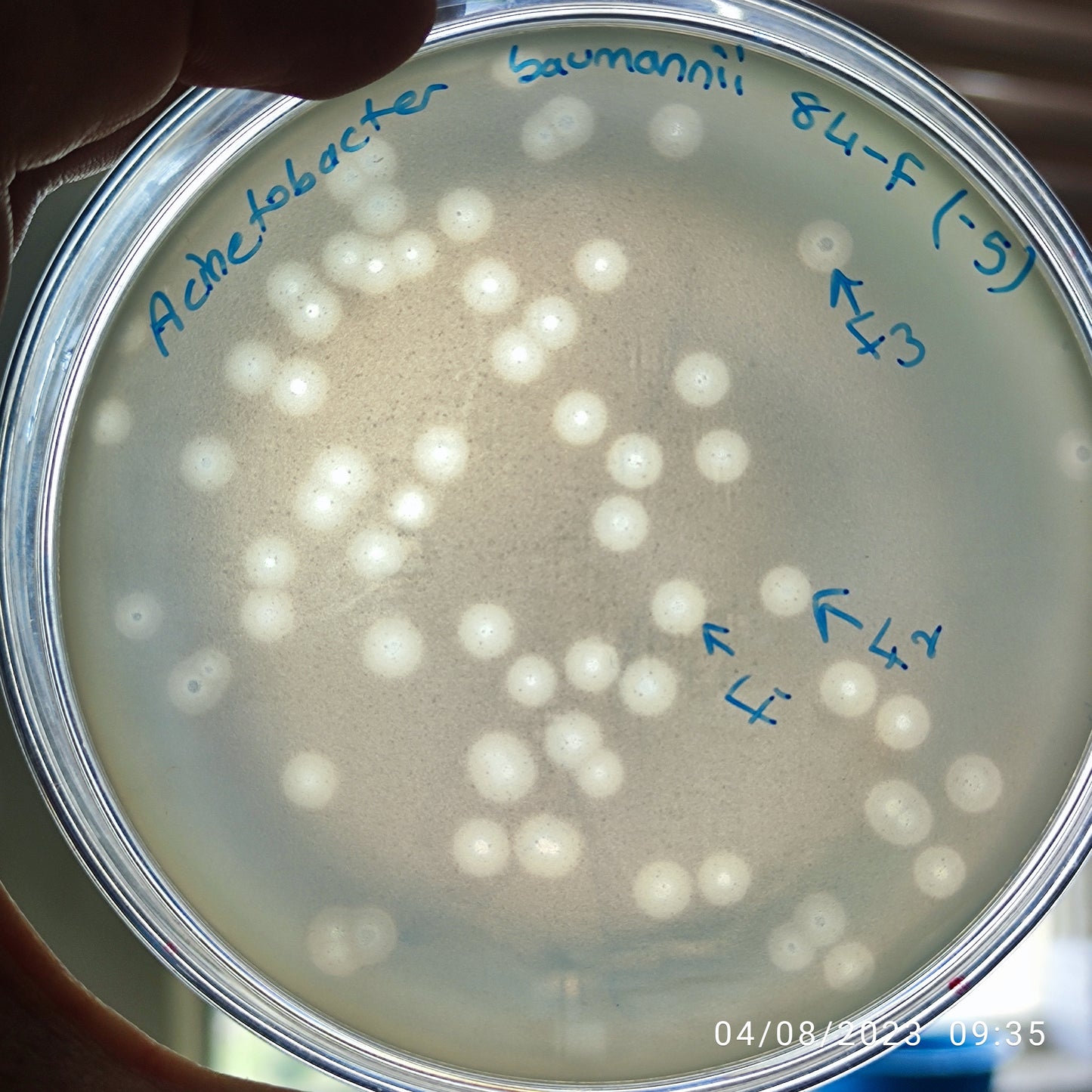 Acinetobacter baumannii bacteriophage 120084F