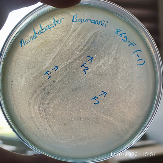 Acinetobacter baumannii bacteriophage 120869F