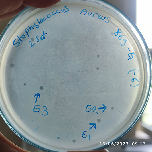 Staphylococcus aureus bacteriophage 152869G
