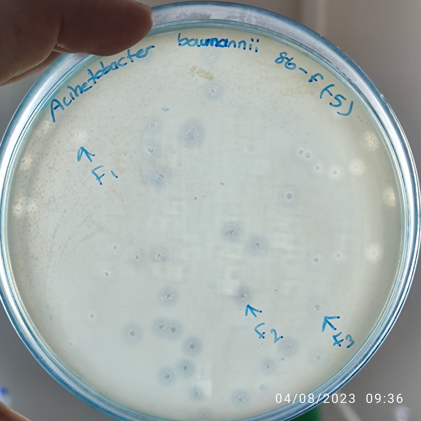Acinetobacter baumannii bacteriophage 120086F