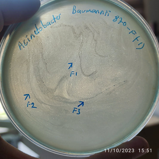 Acinetobacter baumannii bacteriophage 120870F