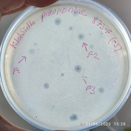 Klebsiella pneumoniae bacteriophage 180873F