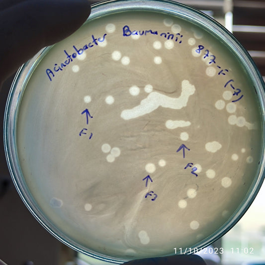 Acinetobacter baumannii bacteriophage 120877F