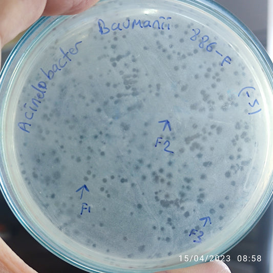 Acinetobacter baumannii bacteriophage 120886F