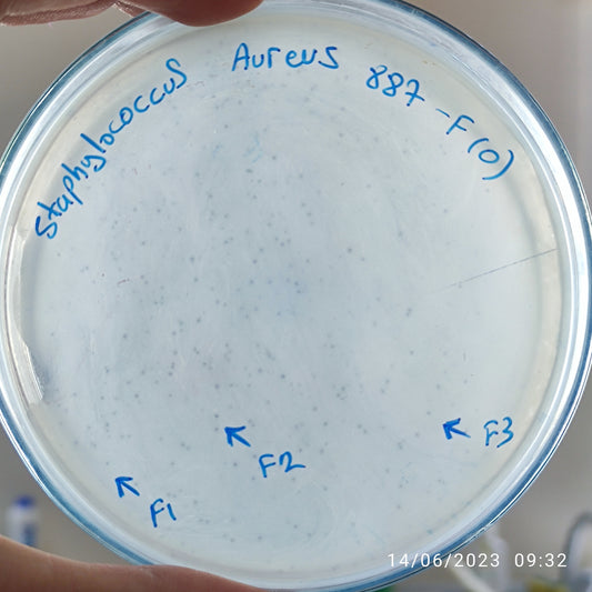 Staphylococcus aureus bacteriophage 152887F