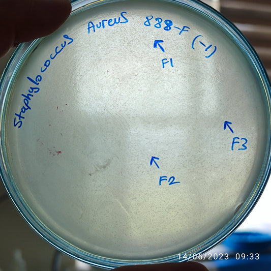 Staphylococcus aureus bacteriophage 152888F