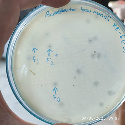 Acinetobacter baumannii bacteriophage 120088F
