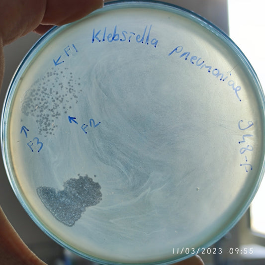Klebsiella pneumoniae bacteriophage 180948F