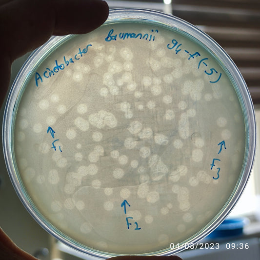Acinetobacter baumannii bacteriophage 120094F